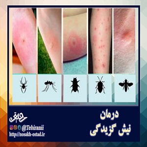 درمان نیش زدگی (گزیدگی) در طب اسلامی